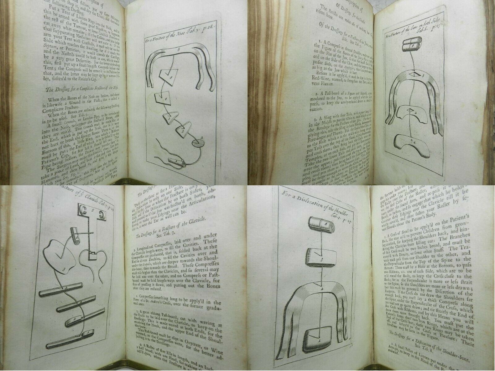 THE COMPLEAT SURGEON: OR, THE WHOLE ART OF SURGERY BY M. LE CLERC 1727 Sixth Ed.